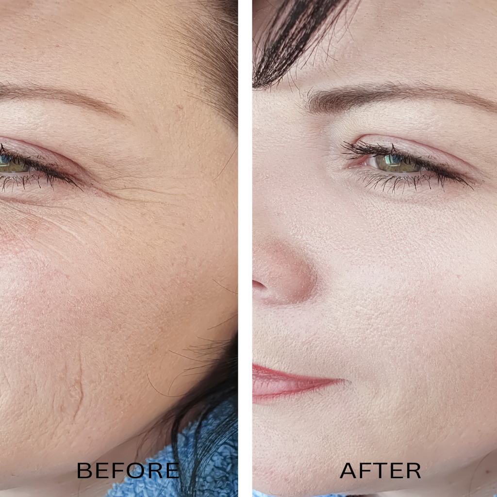 ORGANIC HYALURONIC WRINKLE DEFIER -  For Women and Men