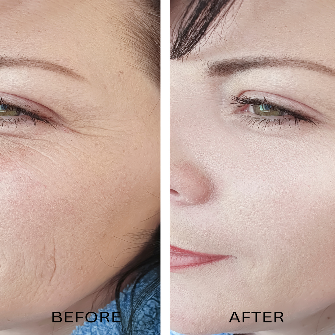 ORGANIC HYALURONIC WRINKLE DEFIER -  For Women and Men